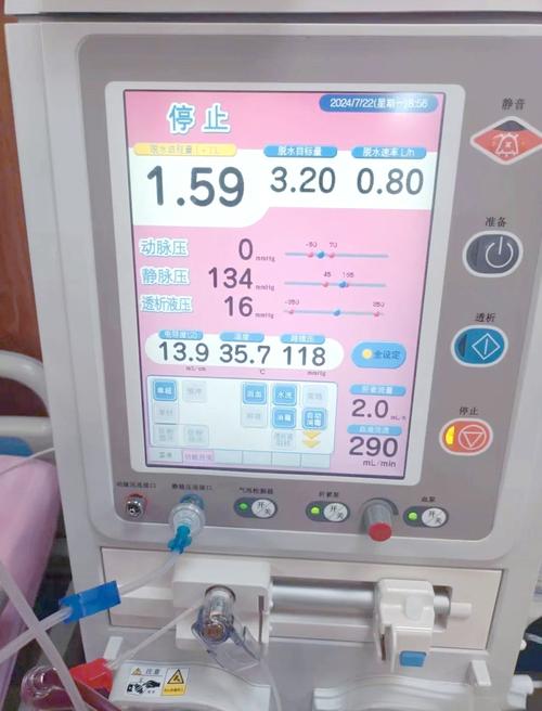血液透析機家用